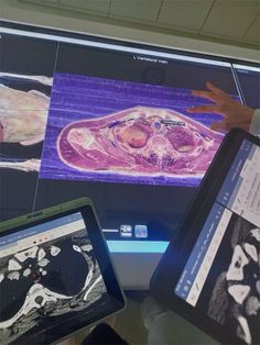 two people looking at an x - ray image on a computer screen with their hands