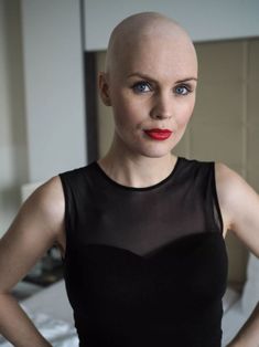 Buzzcut Girl, Bald Hair