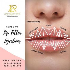 Find Pakistan's top aesthetic treatments for face, skin, body, and hair with the most skilled and experienced experts at London Aesthetics and Rejuvenation Centre in Lahore & Faisalabad Dermal Fillers Lips, Pouting Lips, Facial Injections, Cosmetic Fillers, Bigger Lips, Aesthetic Nursing, Nurse Injector, Aesthetic Nurse, Skin Facts