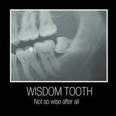 Knowing All About Wisdom Teeth Oral Health Education, Tooth Cartoon, Dental Implant Surgery, Laser Teeth Whitening, Teeth Implants