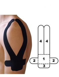 Shoulder Knee Taping, Rotator Cuff Exercises, K Tape, Rotator Cuff Injury, Kt Tape, Rehabilitation Exercises, Kinesio Taping, Shoulder Surgery, Frozen Shoulder