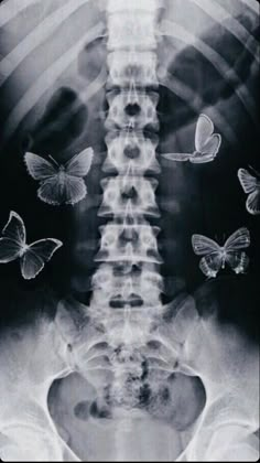 the back of a man's head with butterflies flying around it in black and white