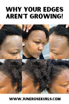 How To Grow Hair Edges Back Fast, Natural Hair Edges Growth Tips, African Hair Products For Hair Growth, Edge Growth For Natural Hair, Hers Hair Growth, Hair Edges Growth Tips, Growing Edges Back Hair Natural, How To Grow Back Edges, Natural Hair Styles For Black Women Thinning Edges