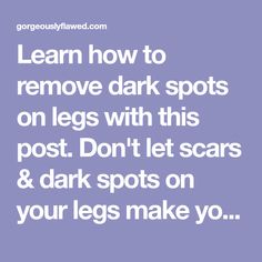 Learn how to remove dark spots on legs with this post. Don't let scars & dark spots on your legs make you feel embarrassed in short clothes! Leg Scars, Dark Spots On Legs, Short Clothes, Spots On Legs, Natural Glowing Skin, Remove Dark Spots, Dark Spots, Spot On, Don't Let