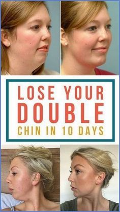 Turkey Neck Exercises, Rid Of Double Chin, Facial Exercise, Double Menton, Turkey Neck, Neck Exercises