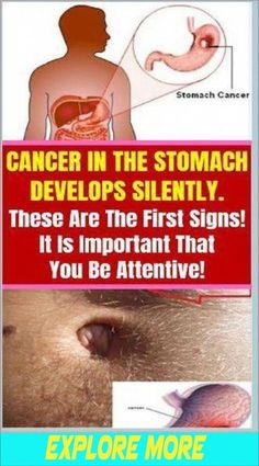 What Is Health, Health Signs, Health Tips For Women, Health Facts, Health Lifestyle, The Signs, Wellness Tips, Healthy Tips