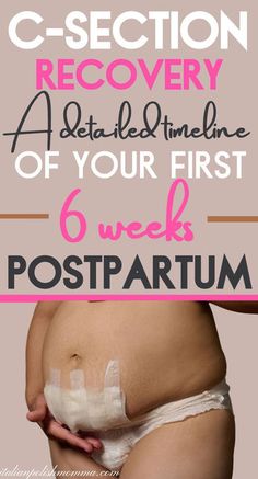 a woman's stomach with the words c - section recovery after bedtime of your first 6 week postpartum