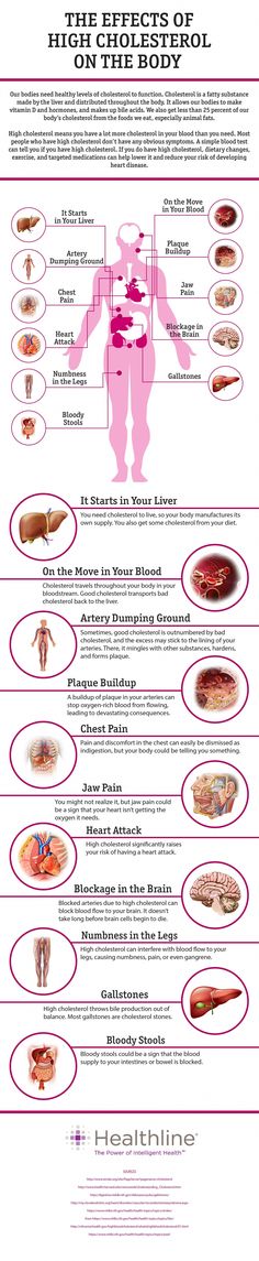 Cholesterol itself isn’t bad. Your body needs some cholesterol to make hormones, vitamin D, and digestive fluids. But high LDL cholesterol levels in your blood can interfere with blood flow throughout your body. If you do have high cholesterol, diet and exercise can help lower it. Learn about the effects. Natural Juice, Natural Remedies For Migraines, Health And Fitness Magazine, Healthy Diet Tips, Reduce Body Fat, Ldl Cholesterol, Cold Home Remedies