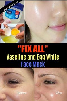 Vaseline Face Mask, Vaseline Face, Face Mask For Wrinkles, Egg Face Mask, Egg White Mask, Egg White Face Mask, Mask Skincare, Beast Disney, White Face Mask