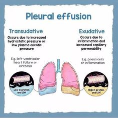 a poster explaining the effects of pleurral effusion on human body and lungs