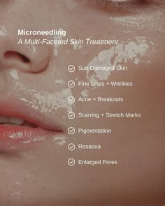 Microneedling is one of our top-selling facial treatments that uses tiny needles to create micro-channels in the skin, stimulating collagen production and improving the texture, tone, and overall appearance of your skin.   Ready to try microneedling? For a limited time we're offering the Repair and Rejuvenate Trio, the ultimate solution for a healthy, smooth complexion!  Available now for the amazing price of only $699 (Value of $853)!   ➡️ Use Code: REPAIR to purchase online Medical Facial Treatments, Skin Consultation Aesthetic, What Is Microneedling, Microneedling Marketing, How Much Product To Use On Face, Microdermabrasion Aesthetic, Skin Clinic Aesthetic, Microneedling Video, Microneedling Before And After