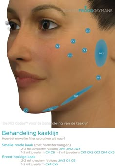 Face Fillers, Facial Anatomy, Botox Face, Cheek Fillers, Facial Fillers, Cosmetic Injectables, Injectables Fillers, Facial Aesthetics, Botox Fillers