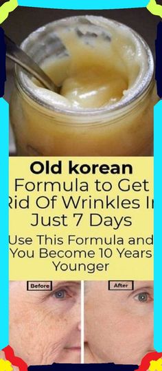 Get Rid Of Wrinkles, Erase Wrinkles, Natural Healing Remedies, Diy Remedies, Natural Therapy, Natural Cream, Wrinkle Cream, Natural Home Remedies, Years Younger