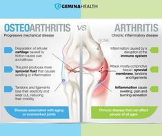 Physical Therapy Student, Pulmonology, Inflammation Causes, Human Body Anatomy, Medical Anatomy, Joints Pain Relief, Medical Knowledge, Anatomy And Physiology