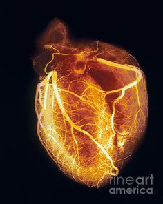 an image of the heart in yellow and orange colors, as well as other images