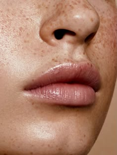 a woman with freckles on her face and nose