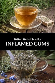 the top 10 best herbs for inflameed gums and how to use them