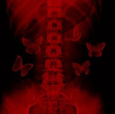 an x - ray image shows butterflies flying over the back of a human skeleton in red light