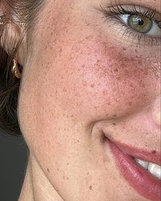 Freckles On Face, Freckled Face, Girl With Freckles, Green Eyes And Freckles Aesthetic, Freckles Summer, Clear Skin With Freckles Aethstetic, Tattooed Freckles, Tattoed Freckles Face