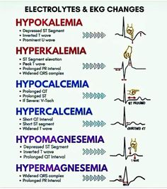 Paramedic Motivation, Er Medicine, Paramedic Tips, Ekg Rhythms, Paramedic Student, Nursing School Motivation