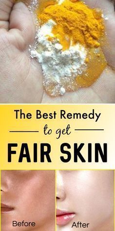 Potato For Whitening Underarms Fair Skin Home Remedies, Fair Glowing Skin, Get Fair Skin, Improve Skin Complexion, Skin Care Face Mask, Face Pack, Beauty Tips For Skin, Skin Complexion