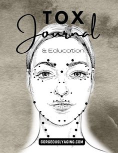 Botox Injection Patterns, Botox Education, Botox Timeline, Botox Reconstitution Chart, Face Mapping