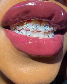 Tooth Gems Front Teeth, Rhinestones On Teeth, Teeth Rhinestones, Butterfly Tooth Gem, Real Delulu, Teeth Jewels, Teeth Grills, Self Work, Teeth Gems