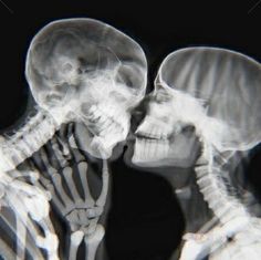 an x - ray image of two skeletons kissing each other