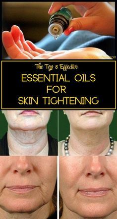 Get Rid Of Saggy Skin, Skin Tightening Essential Oil, Diy Skin Tightening, For Skin Tightening, Essential Oils For Skin, Saggy Skin, Sagging Skin, Diy Skin