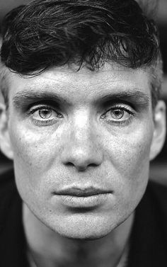 a black and white photo of a man with freckled hair looking at the camera