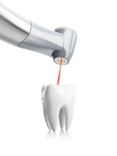 With gentle care and advanced dentistry, there is no reason to wait for Root Canal treatment.  #rootcanaltreatment #oakviileon #canada #dentalhealth #dentistry #teeth #ontario Dental Campaign, Teeth Clenching, Dental Laser, Dental Advertising, Laser Dentistry, Dental Videos, Body Art Photography, Dental Procedures, Root Canal