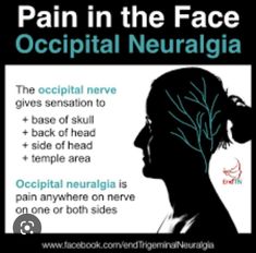 Types Of Migraines, Sick Quotes, Occipital Neuralgia, Joints Pain Remedy, Dental Anatomy, Facial Nerve, Headache Types, Head Pain, Chronic Migraines