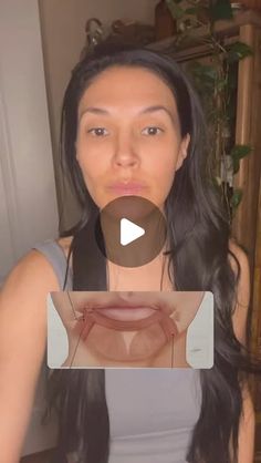 Downturned Mouth, Facial Techniques, Marionette Lines, Mouth Lips, Face Yoga Exercises, Laugh Lines, Facial Yoga, Face Exercises, Facial Exercises