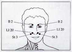 46 likes, 0 comments - eclecticexpanse on September 19, 2017: "@Regrann from @robinharrisacupuncture: Fall allergies? Acupuncture can help. It is quite likely I will go to some of these facial points to...". Sinus Headache Remedies, Sinus Remedies, Getting Rid Of Headaches, Sinus Pain, Sinus Problems, Congestion Relief, Sinus Headache, Sinus Relief, Sinus Pressure