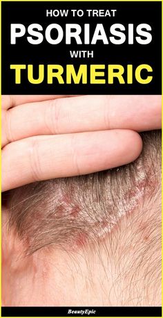 Sick Remedies, Home Health Remedies, Skin Remedies, Natural Health Remedies, Health Remedies, Skin Treatments, Doterra, Aromatherapy, How To Use