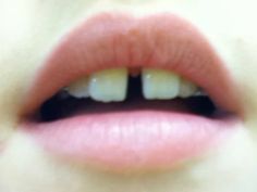 a woman's mouth with white teeth and pink lipstick on the bottom half of her lips