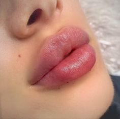 Lips Inspiration, Facial Fillers, Facial Aesthetics, Women Lipstick, Lip Injections, Perfect Lips, Nose Job, Hot Lips