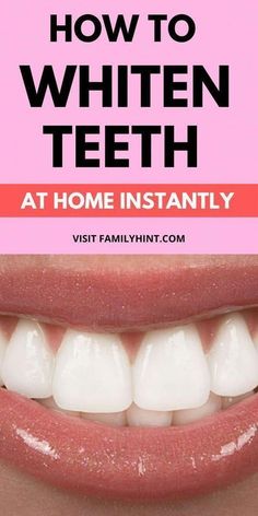 Dental Health Whiten Teeth At Home, Diy Teeth, Teeth Whiting At Home, Smart Hacks, Teeth Whitening Remedies, Teeth Whitening Diy, Dental Cavities, Whiten Your Teeth, Whiten Teeth