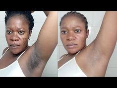 Remove Dark Armpits, Removing Dark Armpits, Get Rid Of Dark Armpits, Dark Patches On Skin, Skin Lightening Diy, Clean Skin Face, Black Armpits, Longer Nails, Nail Growth Tips