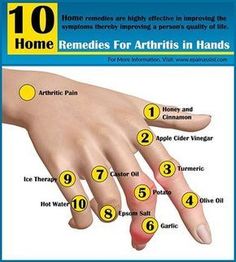 Know the natural home remedies for arthritis in hands, which are available in your very own kitchen. These home remedies are highly effective in improving the symptoms of arthritis of hands thereby improving a person's quality of life. Joints Pain Remedy, Arthritic Pain, Natural Therapy, Quality Of Life, Natural Home, Natural Home Remedies, Natural Medicine, Health Remedies, Home Remedies