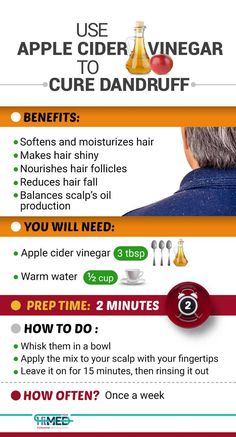 Vinegar For Dandruff, Natural Dandruff Remedy, Hair Mask For Dandruff, Dandruff Solutions, Vinegar For Hair, Rid Of Dandruff, Apple Cider Vinegar For Hair, Homemade Hair Treatments, Dandruff Remedy