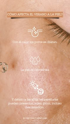 Spa Post Ideas, Skin Care Frases, How To Treat Blackheads, Sking Care, Blackhead Extraction, Skin Care Spa, How To Remove Pimples