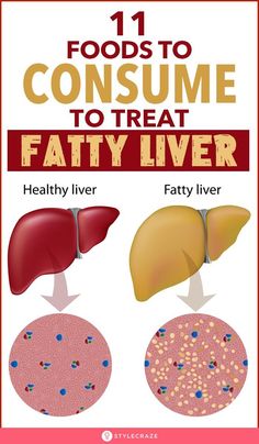 liver fatty natural treatments, liver symptoms disorders, liver detox cleanse remedies, liver detox cleanse from alcohol, liver detox cleanse symptoms, liver fatty natural treatments, liver fatty diet plan, liver fatty foods Makanan Diet