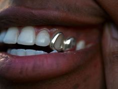 Window Caps Teeth, Single Tooth Grill Men, Window Grillz Teeth, 2 Tooth Grillz, Grills Teeth Aesthetic, Cute Grills For Women, Single Tooth Grill, Cap Grillz, Tooth Jewellery