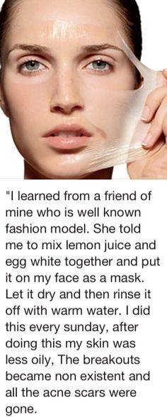 Egg white mask - Was reading about how this is great for blackheads...going to try it out myself. Egg White Mask, Obličejové Masky, Home Remedies For Acne, Trening Fitness, Acne Remedies, Egg White, Face Skin Care, Health And Beauty Tips, Skin Tips