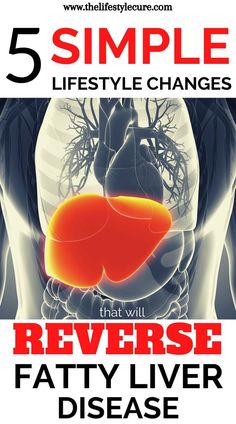 liver fatty natural treatments, liver symptoms disorders, liver detox cleanse remedies, liver detox cleanse from alcohol, liver detox cleanse symptoms, liver fatty natural treatments, liver fatty diet plan, liver fatty foods Quadrants Of The Abdomen