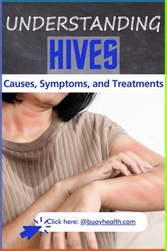 Get informed about hives, their causes, symptoms, and treatments. Discover effective ways to manage this common skin condition.

#buoyhealth  #Hives #SkinHealth #Allergies #Wellness #Health Hives Relief, Allergy Hives, Hives Causes, Home Remedies For Hives, Types Of Skin Rashes, Hives Remedies, Allergies Remedies, Soothing Face Mask, Allergy Remedies