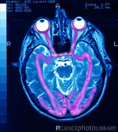 an image of the inside of a human head with different parts in blue and pink