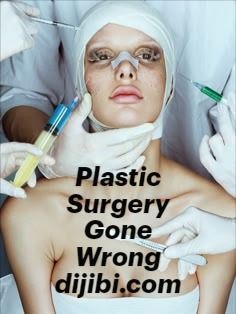 Viral Trend, Cosmetic Surgery, Fashion Photography