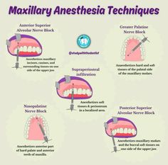 Dental Hygiene School Tips, Dental Hygiene Notes, Dental Hygiene Study, Dentistry Notes, Dental Hygiene Month, Dental Anesthesia, Dentist Aesthetic, Dental Notes